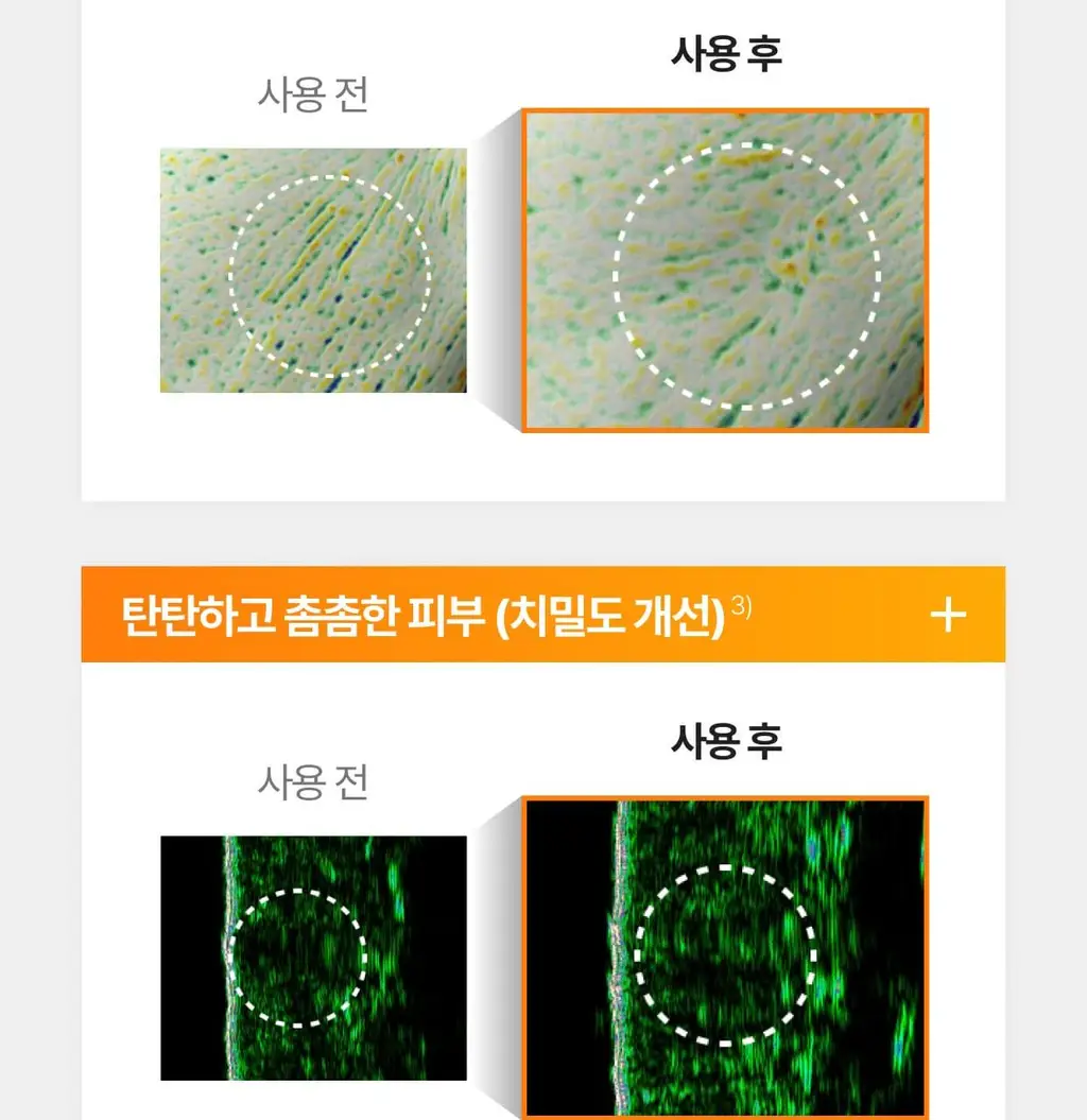 [흔적,기미,미백/TXA] 셀리맥스 트라넥삼산 잡티 크림 35ml 기획 (+14ml) 상세페이지 32